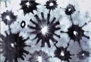 Symmetrical: Crysotile asbestos
