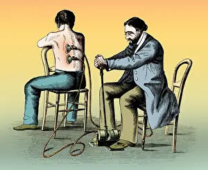 Treadle: Cupping Therapy, 1862