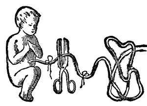 Scissor: Cutting a baby's umbilical cord, 1902