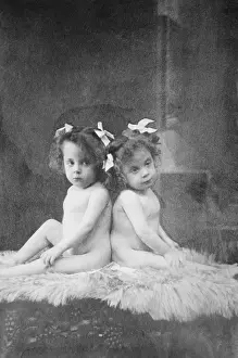 Exploited: Daisy Hilton and Violet Hilton, conjoined twins