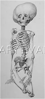 Deformation: Deformed human skeleton