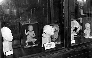 Appear: Deformities exhibited in the Exhibit of Genetics and Eugeni