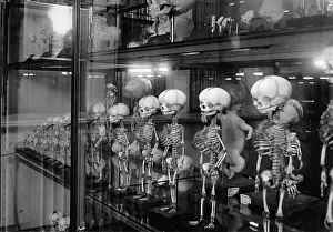 Embryo: Development of the human skeleton