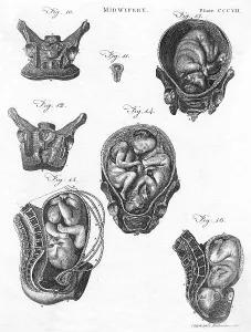 Foetus: Diagrams of foetuses in the womb