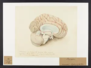 Femmes: Dilatation and Dropsy of the Ventricles