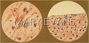 Bacillus: DIPHTHERIA BACILLUS