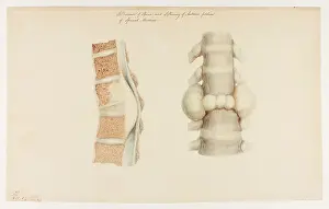 Portion: Disease of the Spine