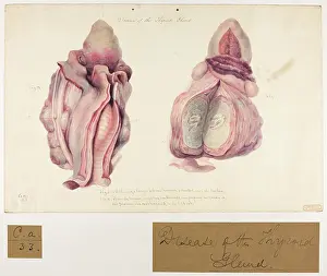 Ucl Library Services Digital Collections: Disease of the Thyroid Gland