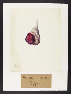 Unsigned: Diseased Testicle