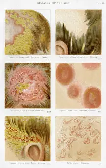 Nettle: Diseases of the Skin - Plate 4