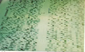 Fingerprinting: DNA Sequencing Gel