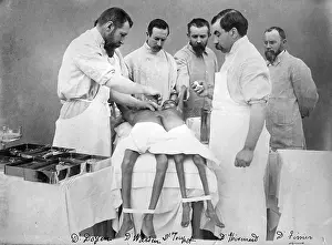 Siamese: Doyen Performs Conjoined Twins Operation, 1902