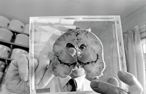 Neuropathologist: Dr Jan Corsellis