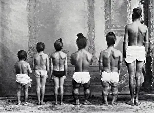Midget: Dwarfism, 1910