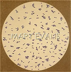 Dysentry: DYSENTRY BACILLUS