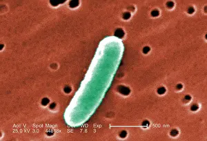 Microbes: E. coli, a common cause of bacterial diarrhea. ?