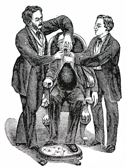 Oxide: Early method of delivering nitrous oxide (laughing gas)