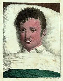 The Kings College Archives And Special Collections: The early stages of yellow fever