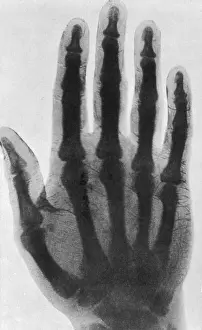 X Ray: Early X-ray, 1897