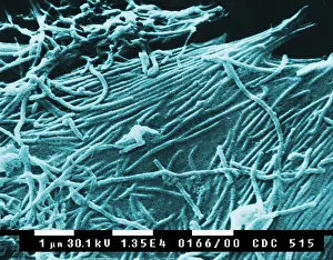 Microbes: Ebola virions (virus particles). Ebola hemorrhagic ?