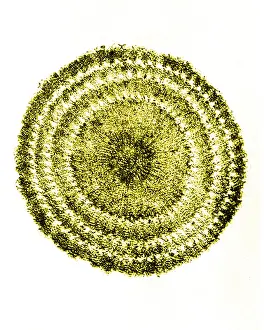Echinus: Echinus Spine Section, Early Photomicrograph