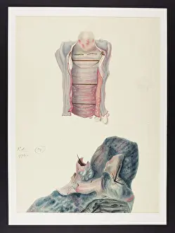 1836: Eczema Impetiginodes & Rubrum