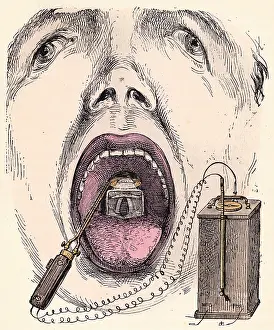 Larynx: ELECTRIC POLYSCOPE/1881