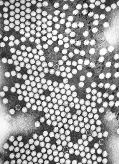 Microbes: Electron micrograph of the poliovirus. 1975.?