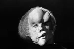 Facial Expression: The Elephant Man (1980)
