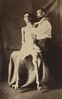 Filth: This emaciated Union soldier was released