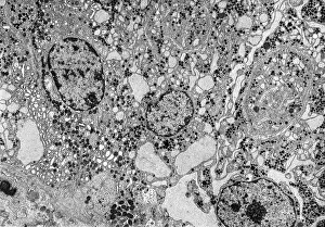 Microscope: Endoplasmic reticulum, TEM