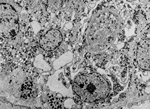 Microscope: Endoplasmic reticulum, TEM