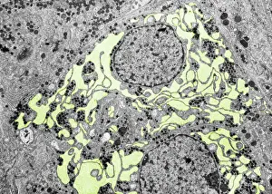 Microscope: Endoplasmic reticulum, TEM