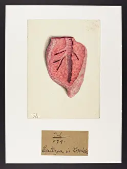 Plantes: Entozoa in Bronchi