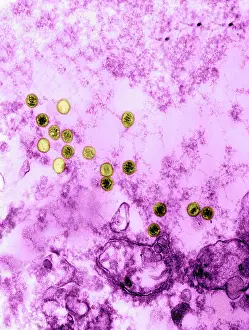 Particular: Epstein-Barr Virus, TEM