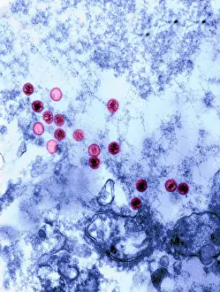 Particular: Epstein-Barr Virus, TEM