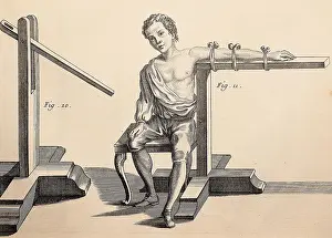 Articulated: Equipment for dislocated arm. Image from the book