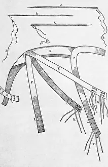 Operative: Equipment for One of Tagliacozzi's Rhinoplasty Methods