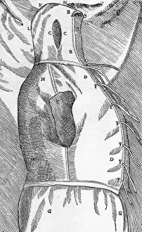 Operative: Equipment for One of Tagliacozzi's Rhinoplasty Methods