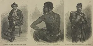 Scarred: Escaped slave Gordon, whose scarred back from