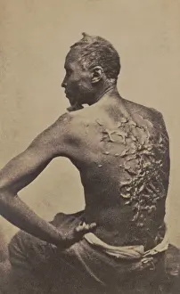 Scarred: Escaped slave Gordon, showing his scarred