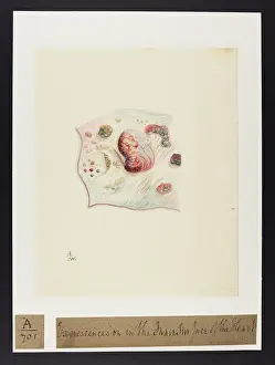 Verso: Excrescences on Inner Surface of Heart