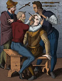 1594: Eye Surgery and Surgical Tools, 1594