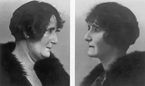 Procedure: Facelift, c. 1920s
