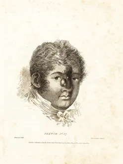 Ulcers: Fatal tumor on the face of a gentleman from Birmingham