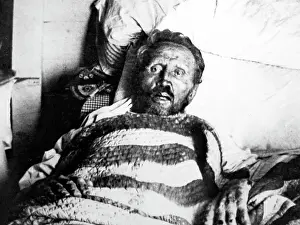 Leprosy: Father Damien on his death bed in 1889