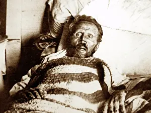 Leprosy: Father Damien on his death bed in 1889