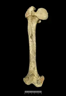 Femur: Femur of Achondroplastic Dwarf