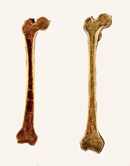 Femur: Two Femur Bones Showing Marrow, 1897