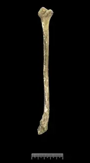 Fibula: Fibula of Achondroplastic Dwarf